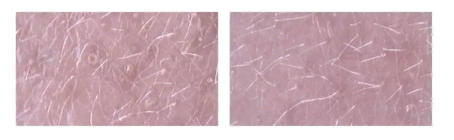 肌の汚れ落ち比較